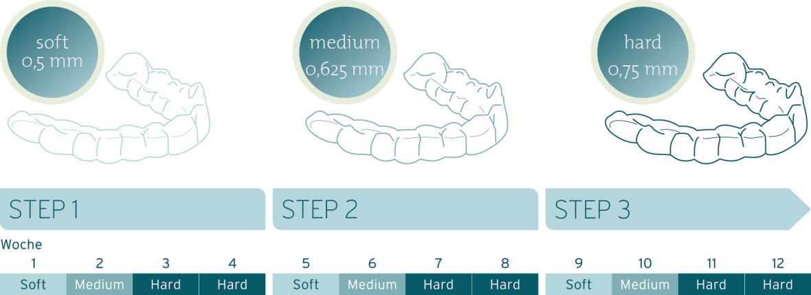 CA® 3 Schienen System, deutsch, CA® CLEAR ALIGNER, Illustration, Katalo